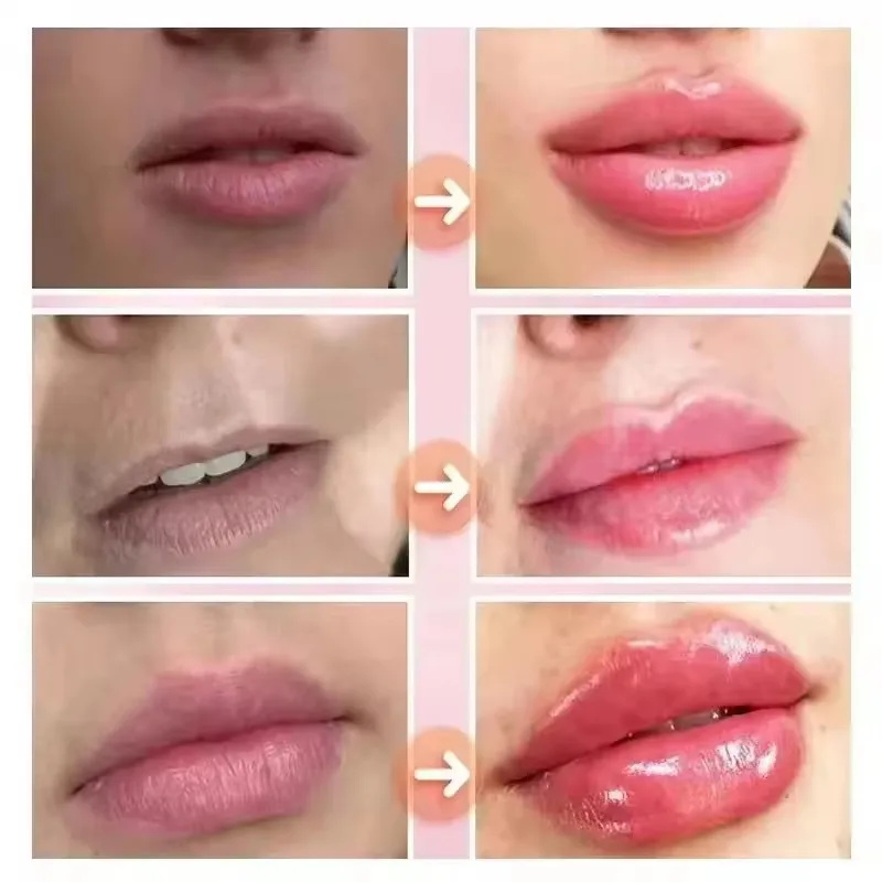 Huile essentielle repulpante i - Lip Gloss Plumping avis et prix