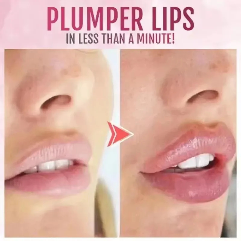 Huile essentielle repulpante i - Lip Gloss Plumping avis et prix