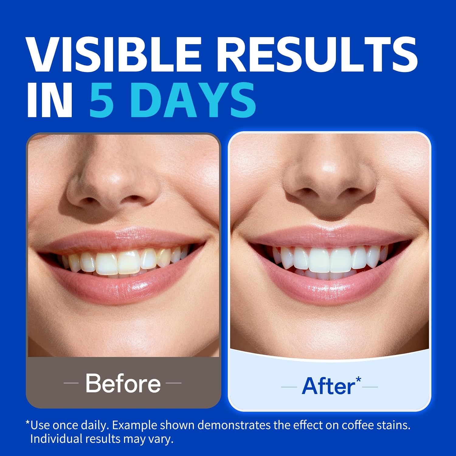 1/7 paires de bandes blanchiss - Teeth Whitening Strips avis et prix